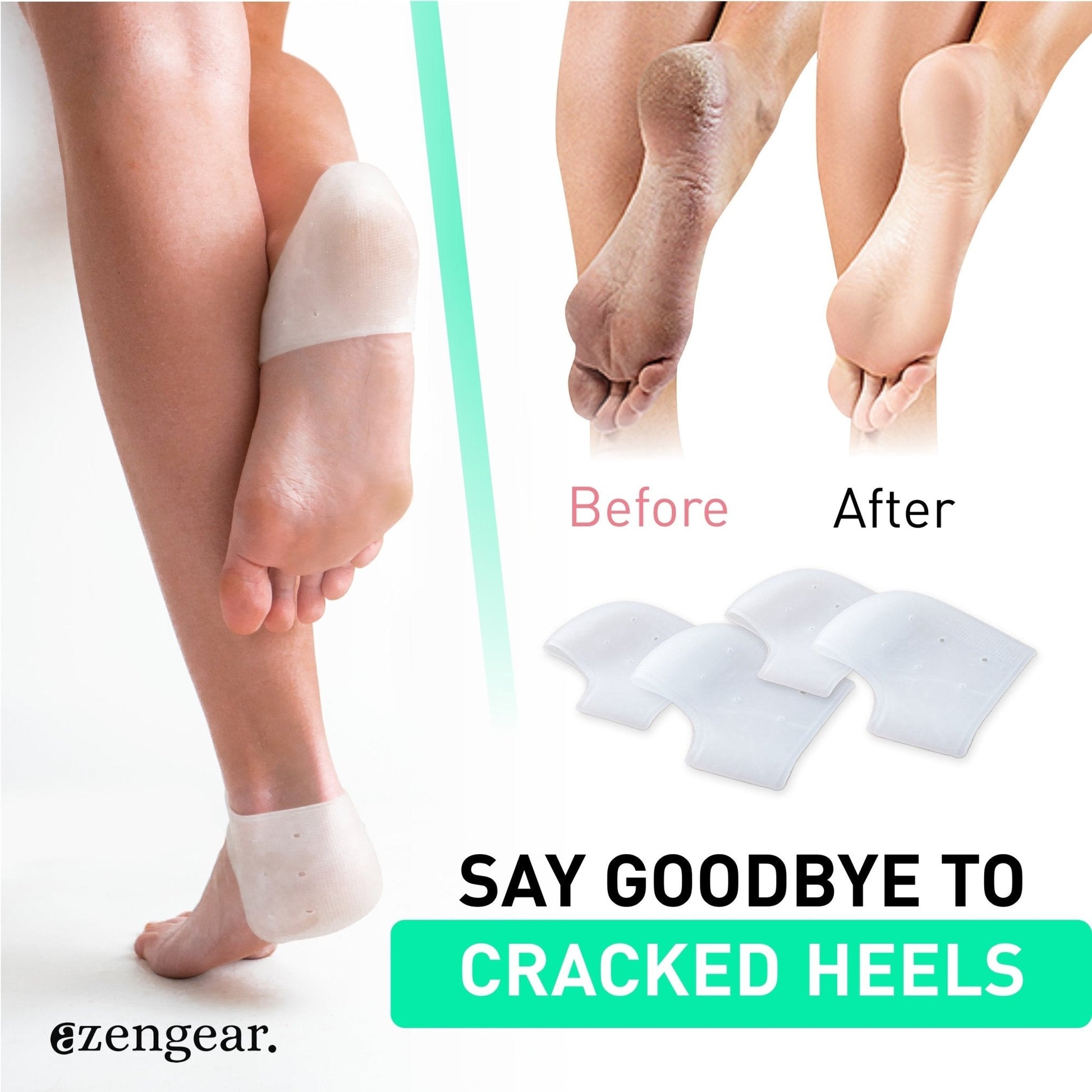 Before and after showing cracked heels with ezengear heel pads, featuring the brand name.